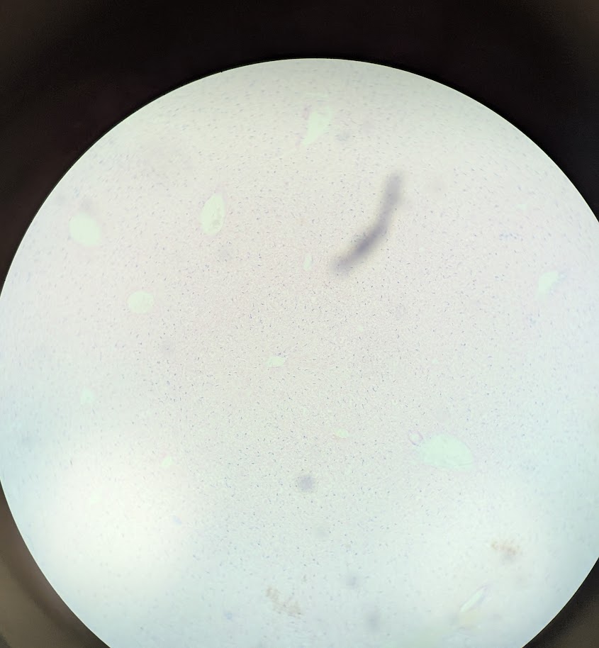 <p>Where in the body is this</p>