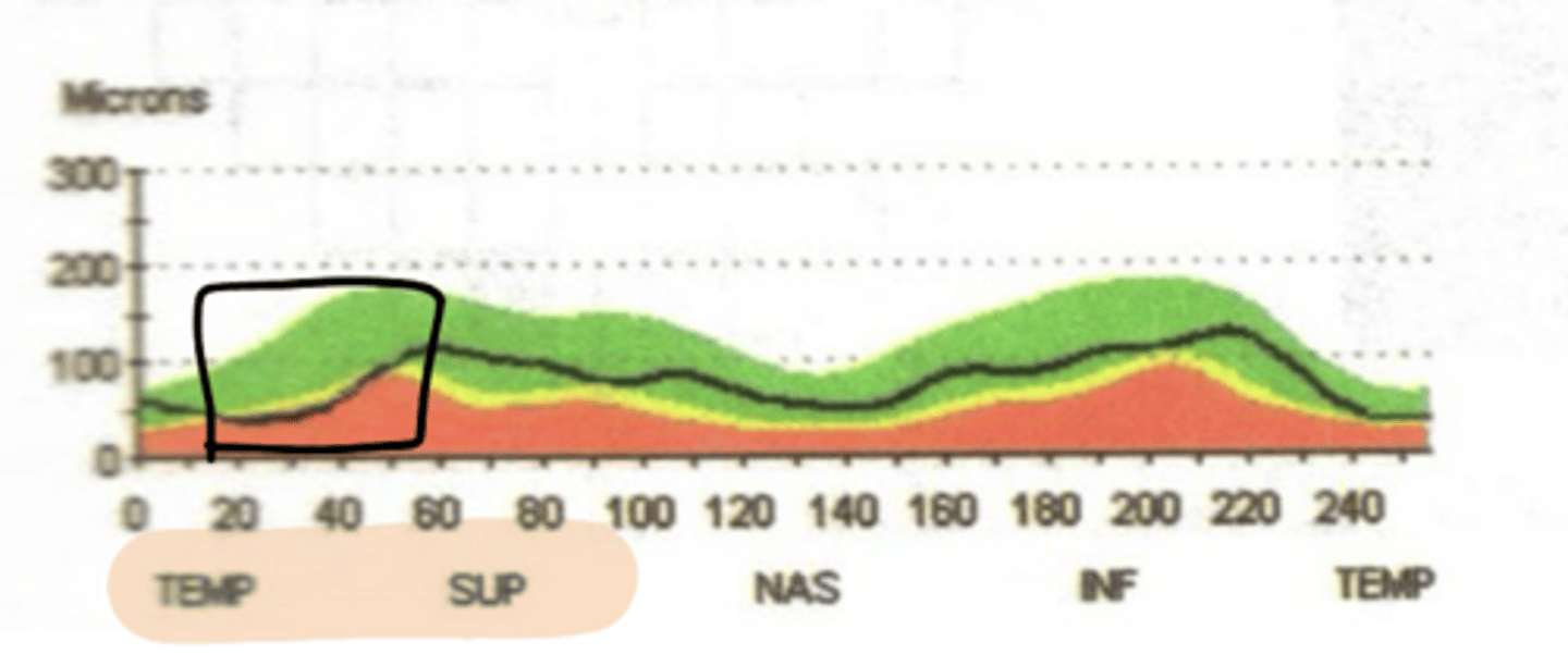 <p>Where is the thinning in this TSNIT curve?</p>