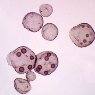 <p>green algae</p><ul><li><p>volvox colonies</p></li></ul><p></p>