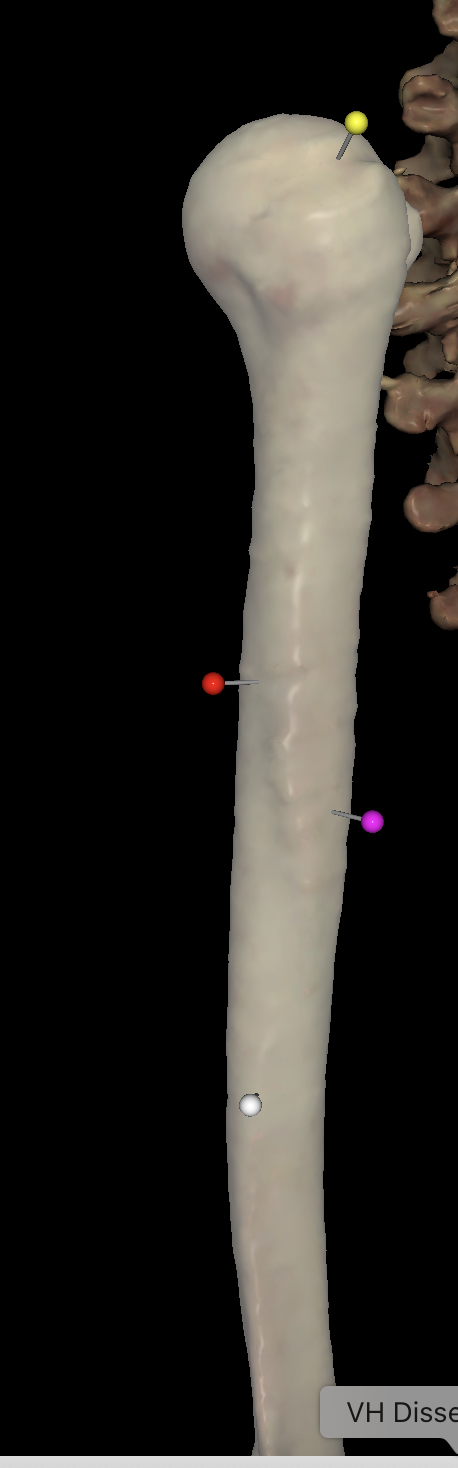 <p>What is the pink pin called on the right humerus?</p>