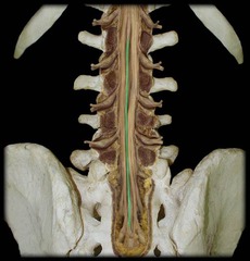 <p>Filum Terminale; vertical movement</p>