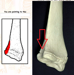 <p>Notch on the other side from the styloid proccess where the radius attaches to ulna</p>