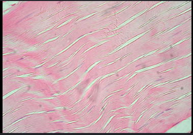 <ul><li><p>parallel collagen fibers </p></li><li><p>fibroblast cells </p></li><li><p>in tendons &amp; most ligaments </p></li><li><p><strong>FUNCTION </strong>→ filtration in spleen </p></li></ul><p></p>