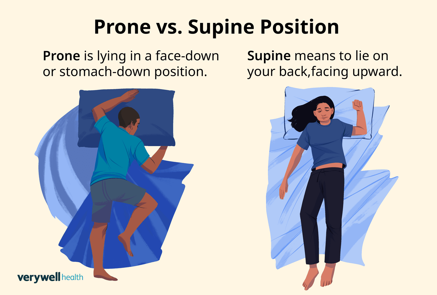 <p>supine: a position in which the body is lying face up</p><p>prone: position in which the body is lying face down</p>