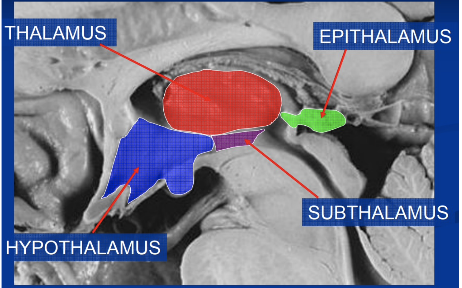 <p>Thalamus, </p><p>Hypothalamus, </p><p>Epithalamus, </p><p>Subthalamus, </p><p>Metathalamus</p>