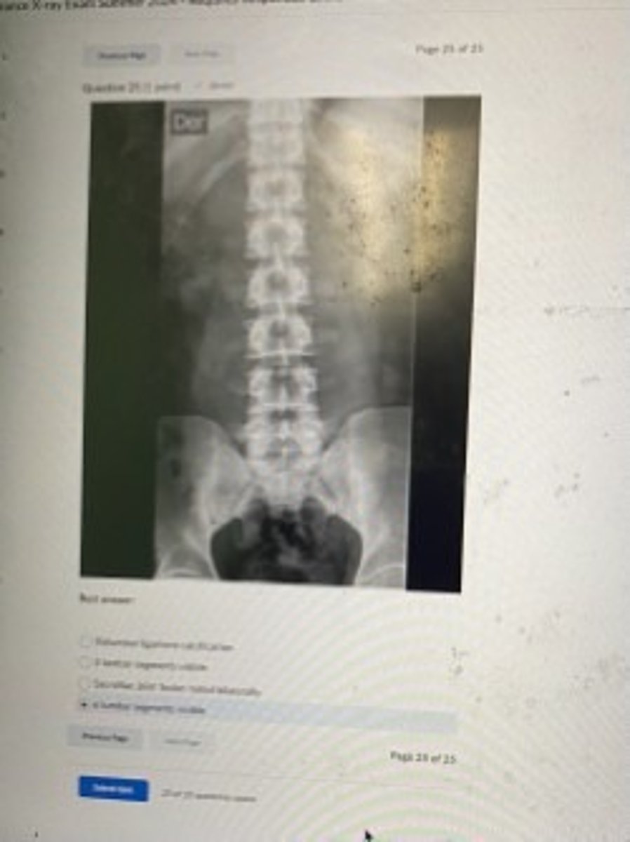 <p>6 Lumbar segments visible</p>