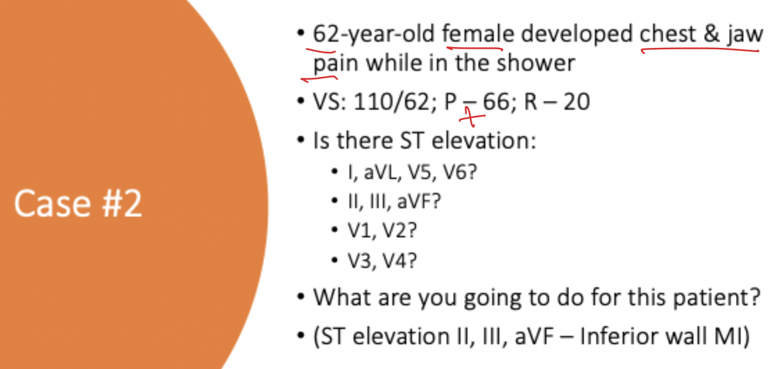 <p>In Case #2, a patient with chest and jaw pain had <strong><u>ST elevation in II, III, and aVF.</u></strong> What is the diagnosis?</p>