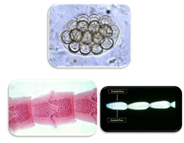 <ul><li><p>macroscopic (with eyes) ID of <strong><em><u>PROGLOTTIDS IN STOOL</u></em></strong></p><ul><li><p>may be motile when freshly passed</p></li></ul></li><li><p>microscopic ID of<strong><em><u> EGGS in STOOL</u></em></strong></p><ul><li><p>large packets containing 15-25 eggs</p></li></ul></li></ul><p></p>