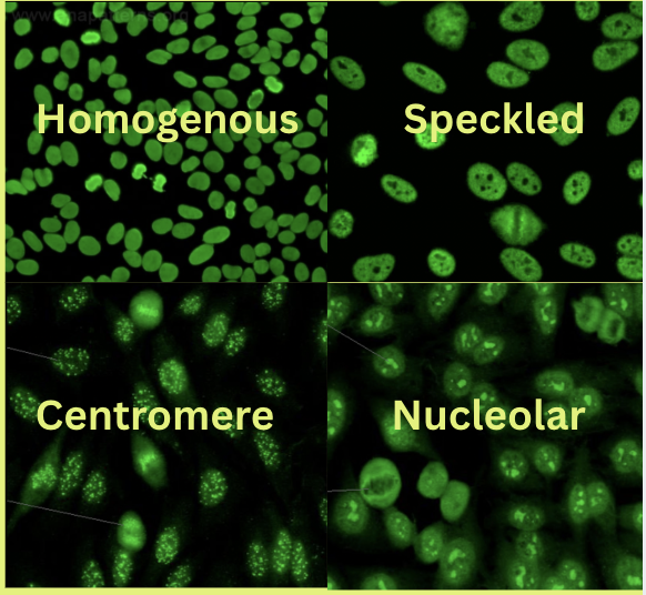 <p>Positive: Fluorescence pattern (homogeneous, speckled, nucleolar, centromere)</p><p>Negative: No Fluorescence</p>