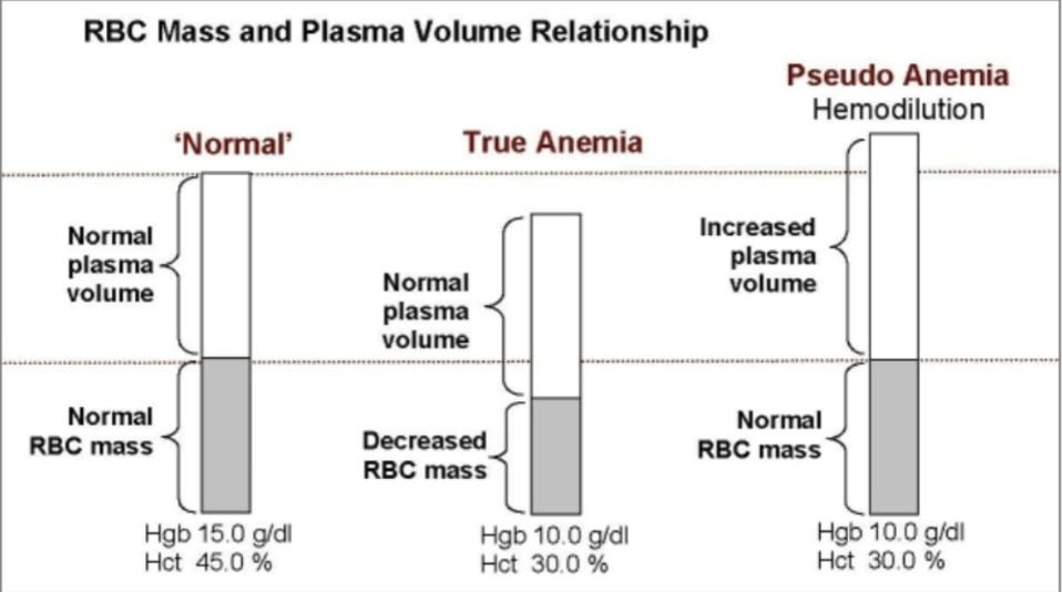 <ul><li><p><span style="background-color: transparent;"><strong>True Anemia</strong>: decrease RBC mass and normal plasma volume</span></p></li><li><p><span style="background-color: transparent;"><strong>Pseudo or Dilution Anemia</strong>: normal RBC mass and increased plasma volume</span></p></li></ul><ul><li><p><span style="background-color: transparent;">High amounts of IV fluid administration, or fluid accumulation in congestive heart failure or pregnancy</span></p></li></ul><p></p>
