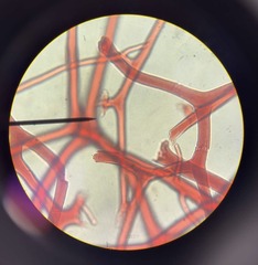 <p>Fibrous protein similar to collagen that forms the flexible internal skeleton of many sea sponges </p><p>Phylum: Porifera</p>