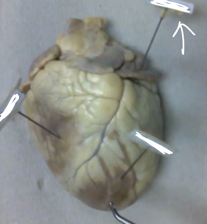 <p>(inside left auricle)</p>