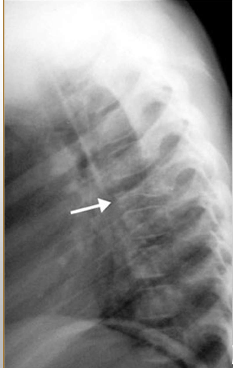 <p>What diagnosis does this pediatric patient have</p>