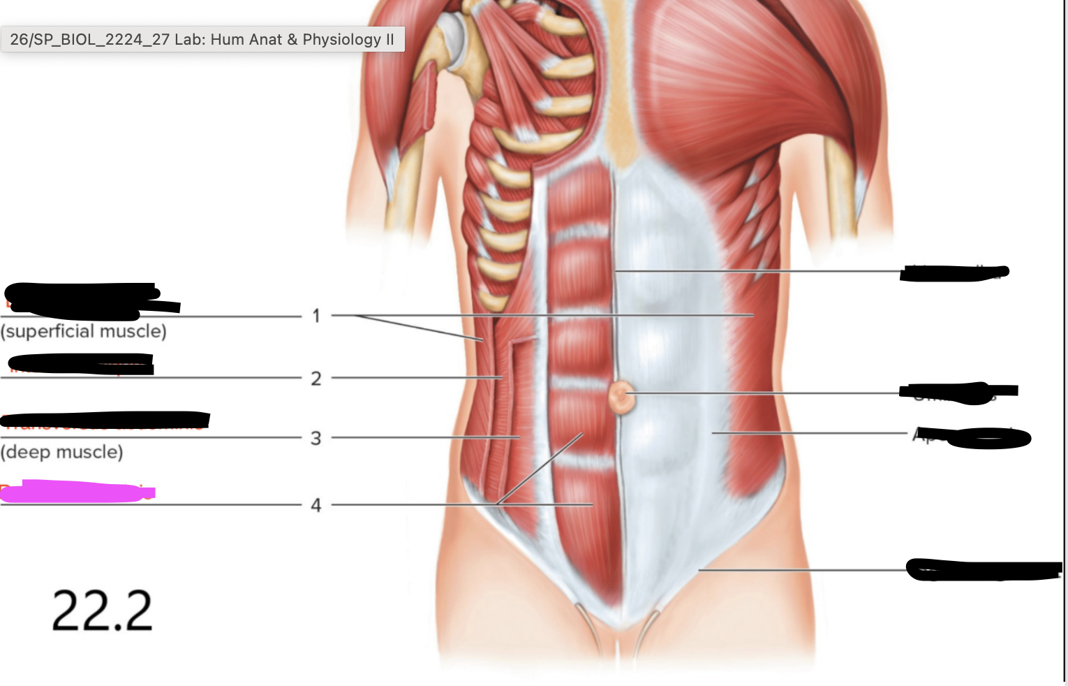 <p>Vertebral column</p>