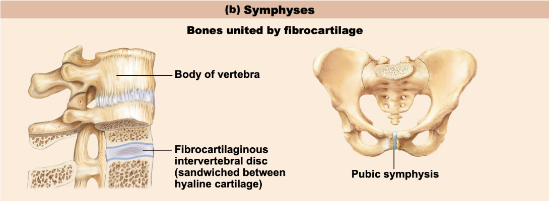 <p>fibrocartilage unites bones, resists tension and compression; hyaline cartilage present as articular cartilage; slightly movable joints that provide strength with flexibility</p>