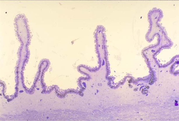 <p>ciliary epithelium structure </p>