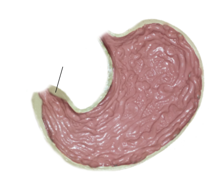 <p><span>Name the structure</span></p>