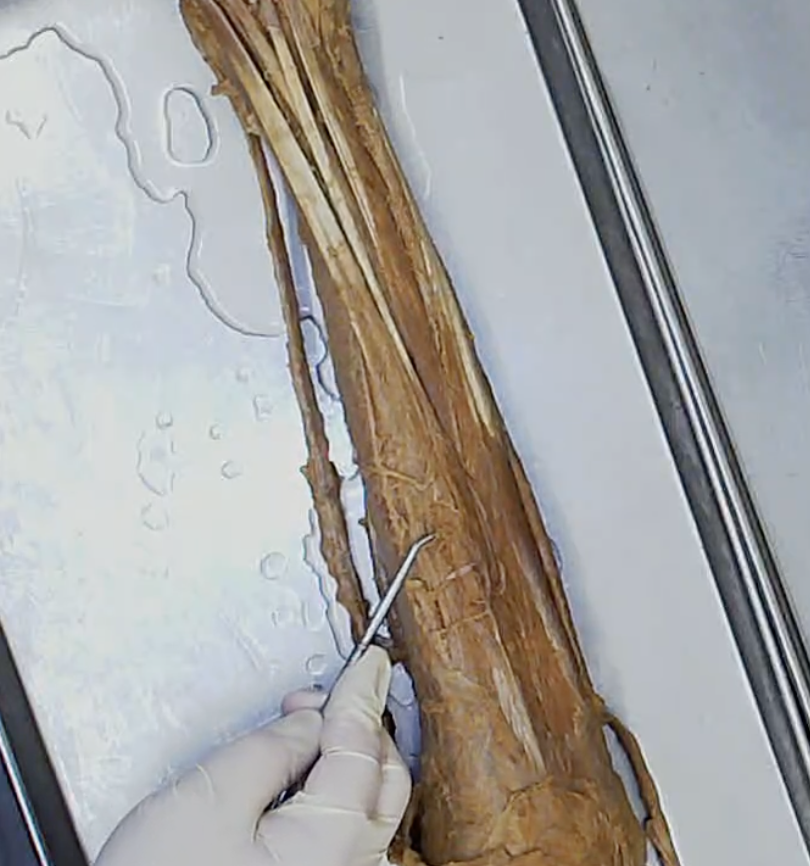 <p>Where he is pointing</p>