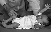 <p>Primitive Reflex: When head is extended, arms and legs both flex.</p>