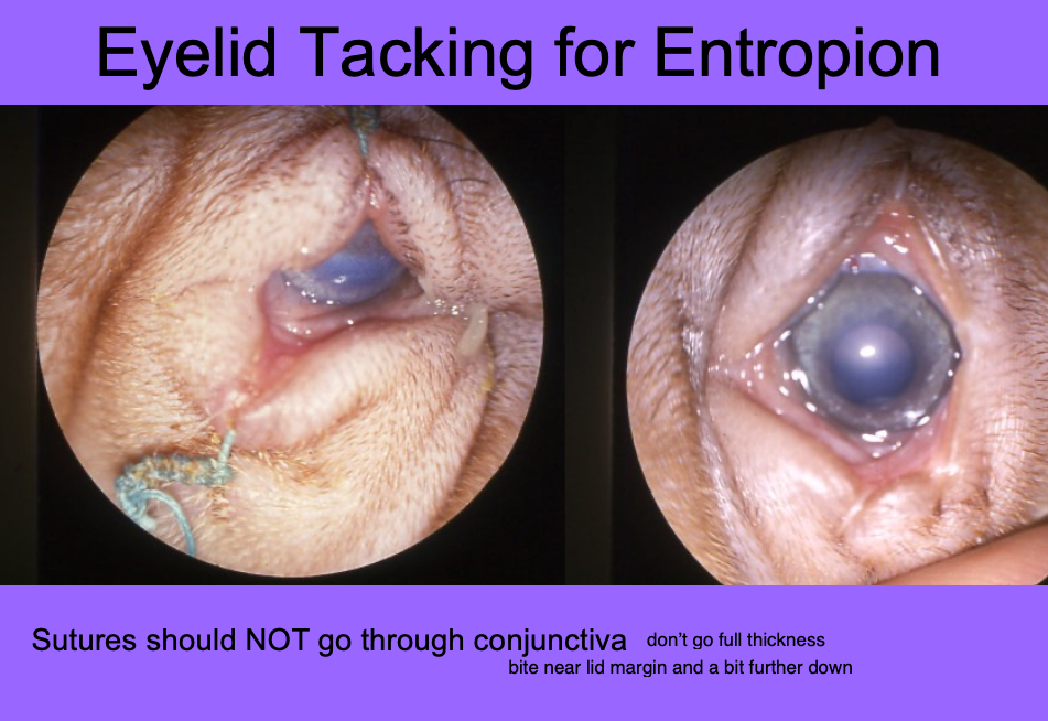 <p>Sutures should NOT go through conjunctiva.</p>