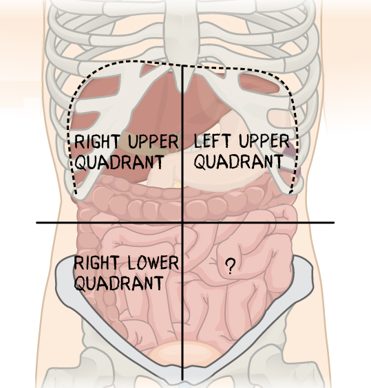 <p>Which abdominopelvic quadrant is missing?</p>