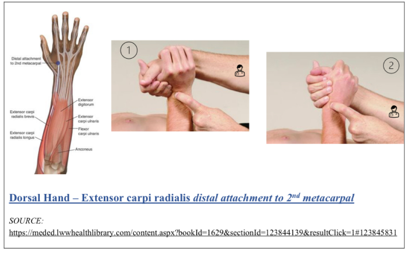 <p>Wrist extension, slight abduction (radial side)</p><p>Distal end and Dorsal surface of 2nd metacarpal in extensor carpi radialis</p><p>Like if you palpate 2nd MC joint then go down to tendon</p><ol><li><p>pt either seated or supine, physician faces pt</p></li><li><p>pt wrist extended and abducted (radial deviation)</p></li></ol><p></p>