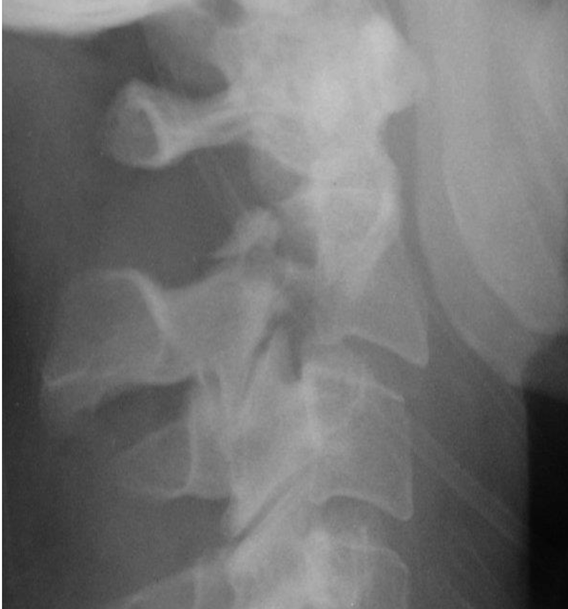 <p>What is the diagnosis?</p>