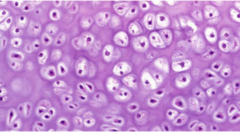 <p>supportive connective tissue, consists of cells (chondrocytes) lying in groups of two or more</p>