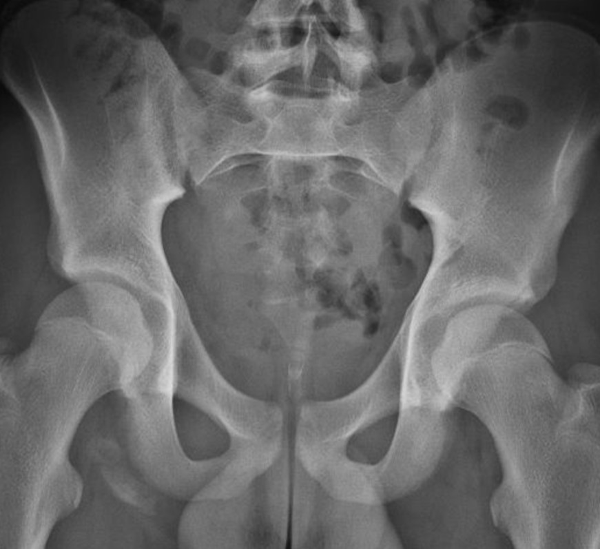 <p>What is the diagnosis?</p>