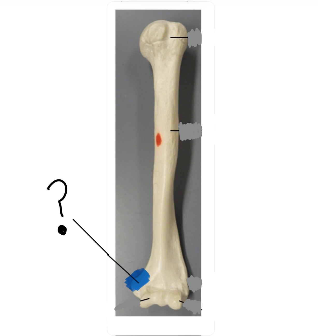 <p>Bone name and specific structure</p>