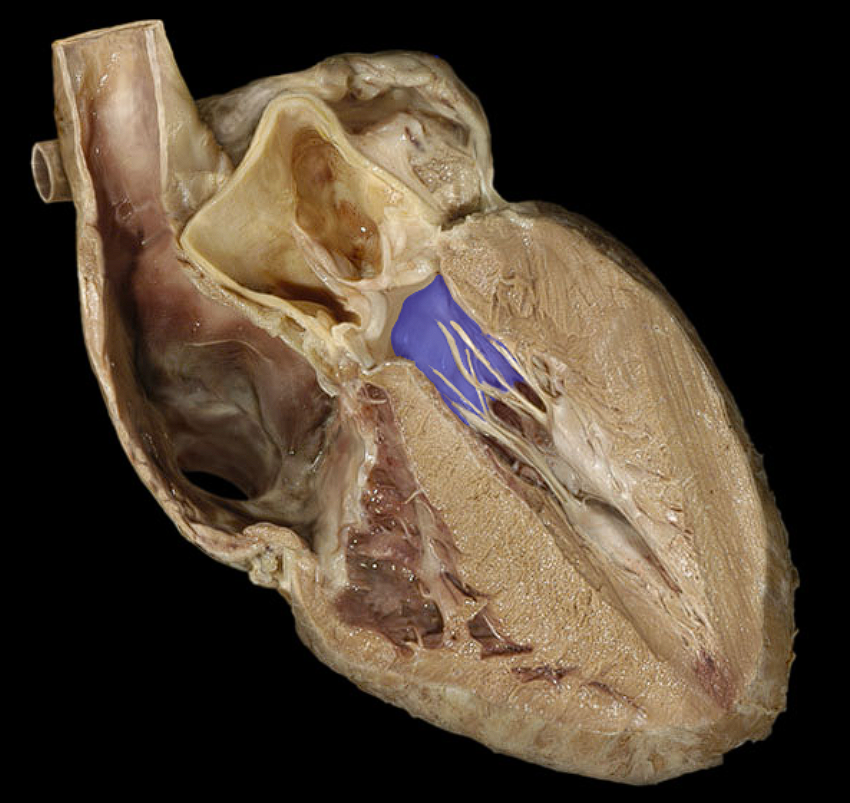 term image