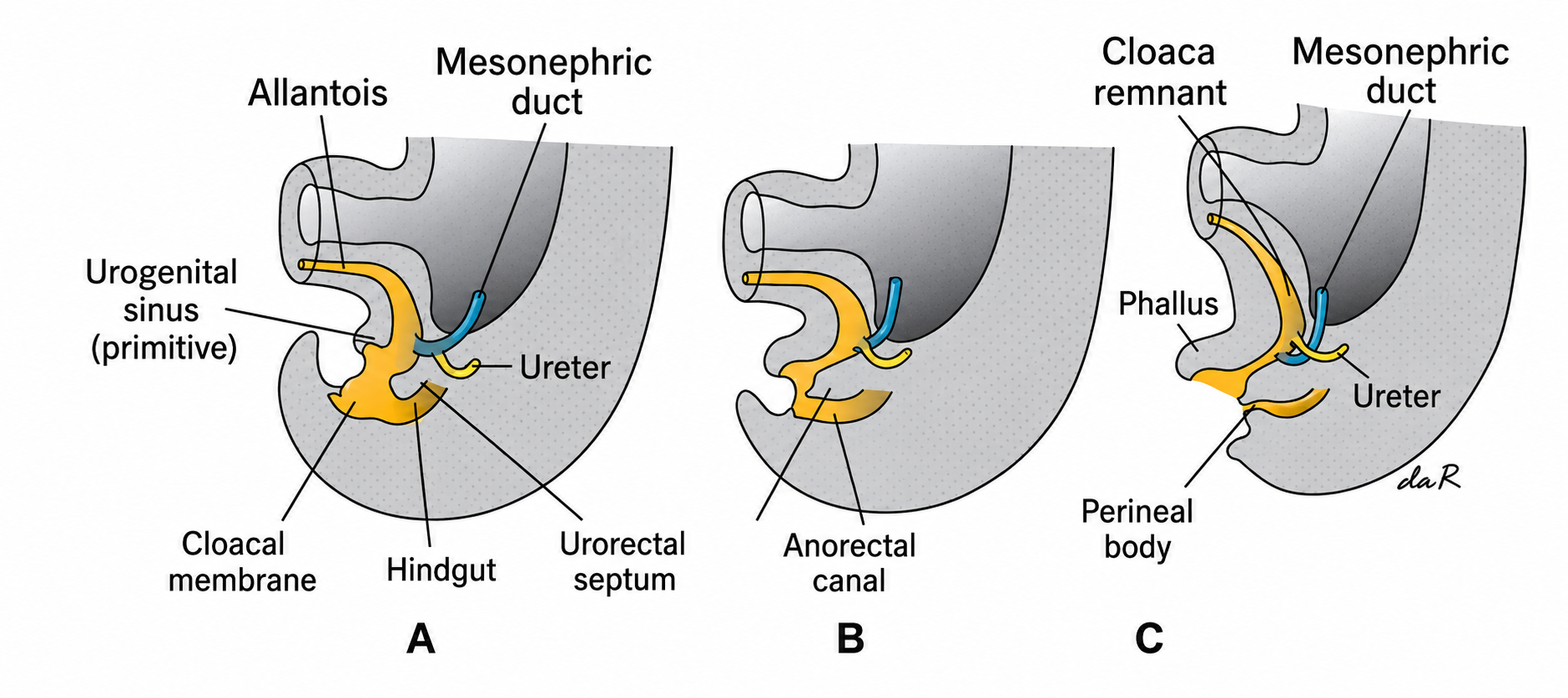 <p>B. Ghi chú 2 (Uro-rectal septum)</p>