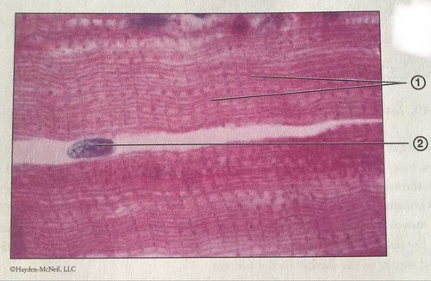 <p>Which type of muscle tissue is this? What is #2?</p>