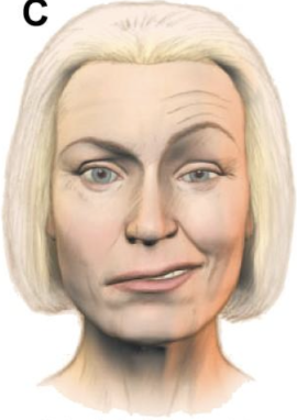 <p>La siguiente imágen corresponde a:</p>