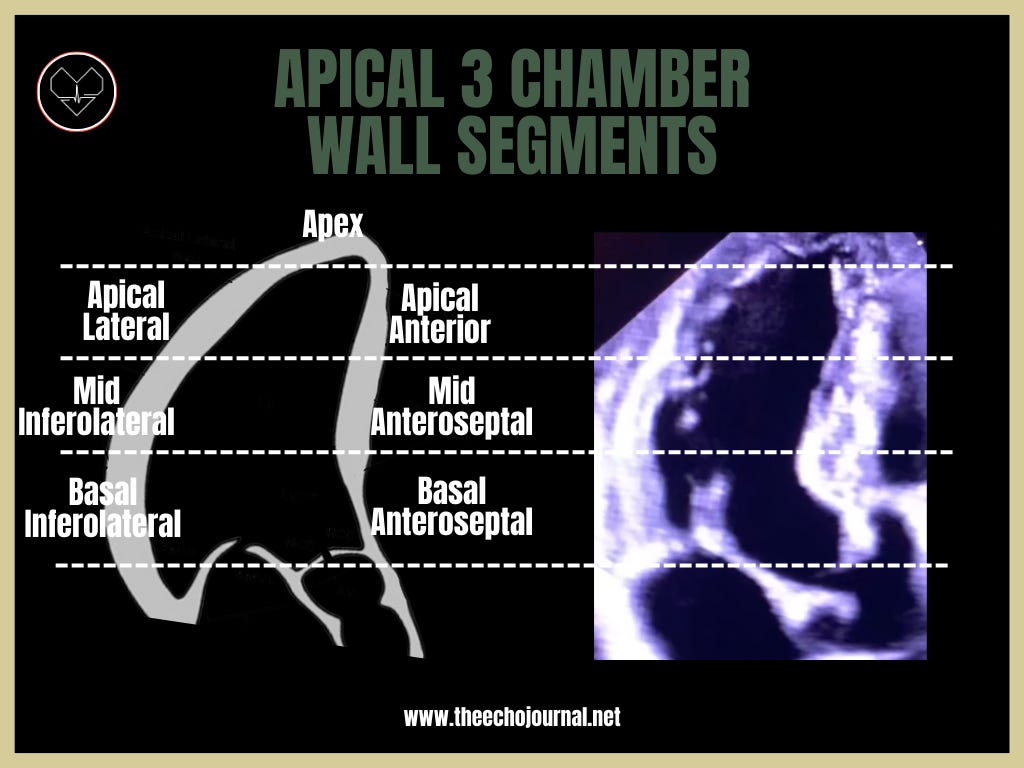 <p>Apical cap, apical septal, mid anteroseptal, basal anteroseptal, apical lateral, mid inferolateral, basal inferolateral.</p>