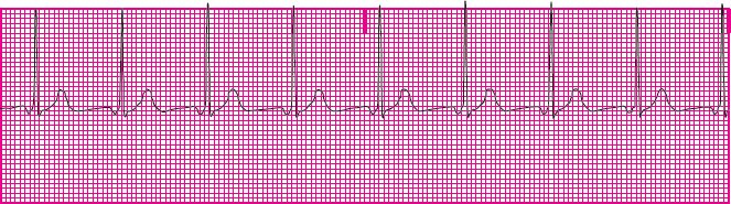 <p>Which rhythm is this?</p>