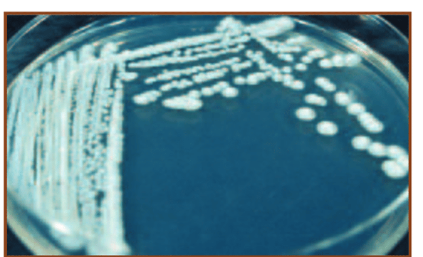 <p>Asci produced on ascospore media</p>