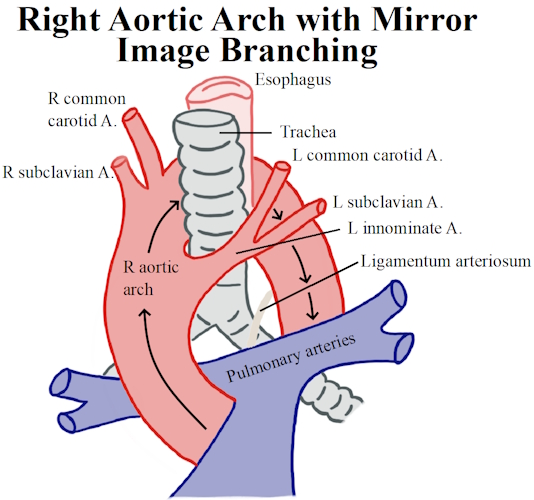 <p>Answer: The right pulmonary artery and left main bronchus.</p><p>Extra Information:</p><ul><li><p>These relationships help anatomically identify the arch in the thorax.</p></li></ul><p></p>