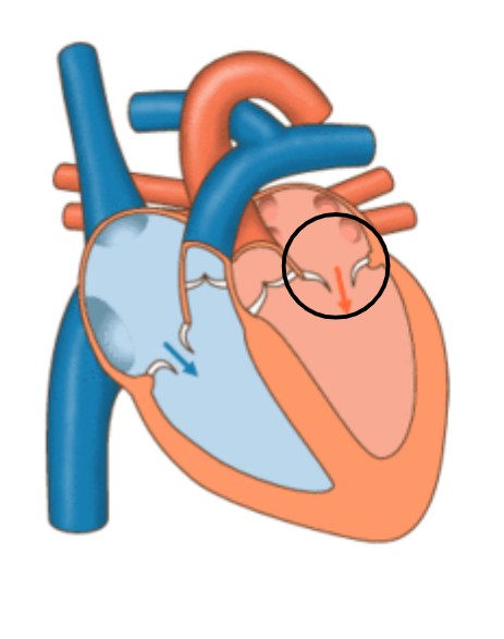 <p>bicuspid (mitral) valve</p>