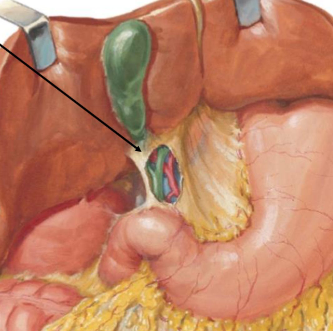 <p>Hepatic portal vein (deepest), hepatic artery proper, common bile duct (Right*)</p>