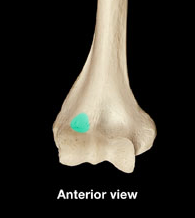 <p>What structure is highlighted?</p>