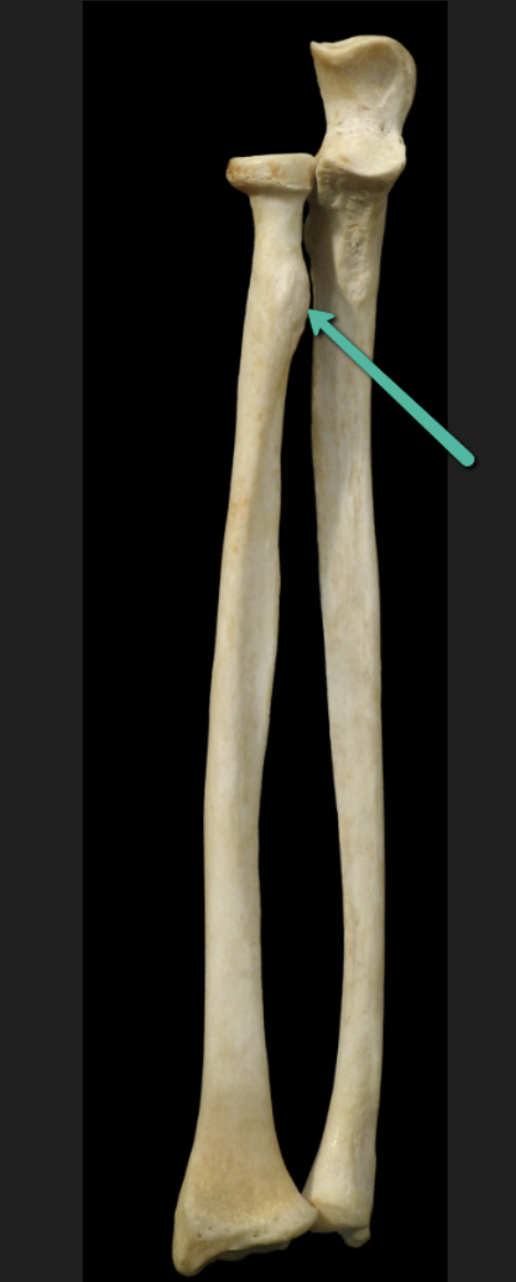 <p><span><strong>Identify the bone marking indicated by the pointer.</strong></span></p>