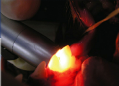 <p>Is this normal dental light transmission? Or abnormal? What is this process called?</p>
