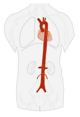 <p>largest artery in the body; carries oxygenated blood to the body</p>