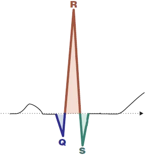 <p>third interval</p><p>Ventricular depolarization (atria repolarizing simultaneously)</p>