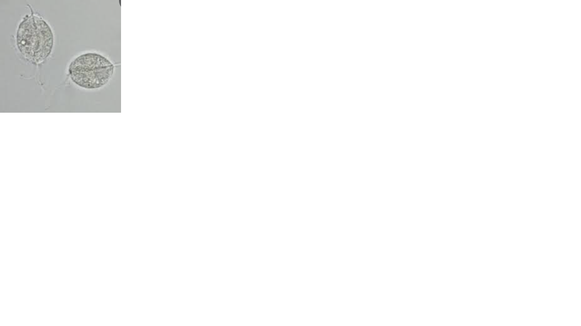 <p>Name the protozoan</p>