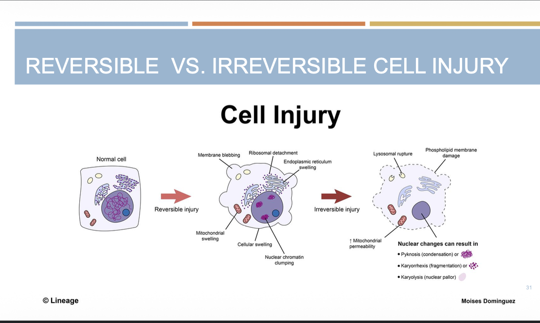 <p><span>Reversible injury is characterized by cellular swelling and recovery after removal of the stress, whereas irreversible injury involves severe mitochondrial and membrane damage leading to necrosis or apoptosis.</span></p>