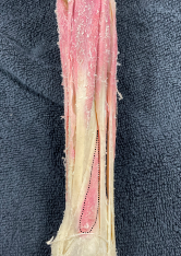 <p>Identify the muscle</p>
