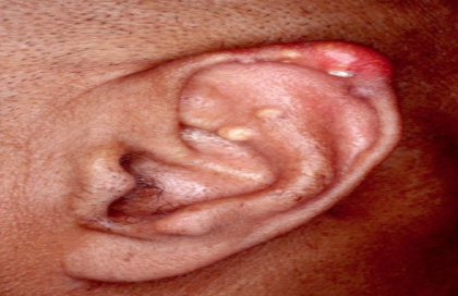 <p>What pathology is shown?</p>