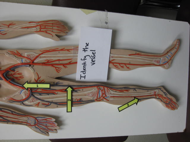 <p>Identify The Vessel 1, 2, and 3?</p><p>Lab Image 3-16</p>